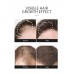 SKIN EVER Масло для роста волос Hair Growth Essential Oil, 30ml