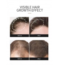 SKIN EVER Масло для роста волос Hair Growth Essential Oil, 30ml